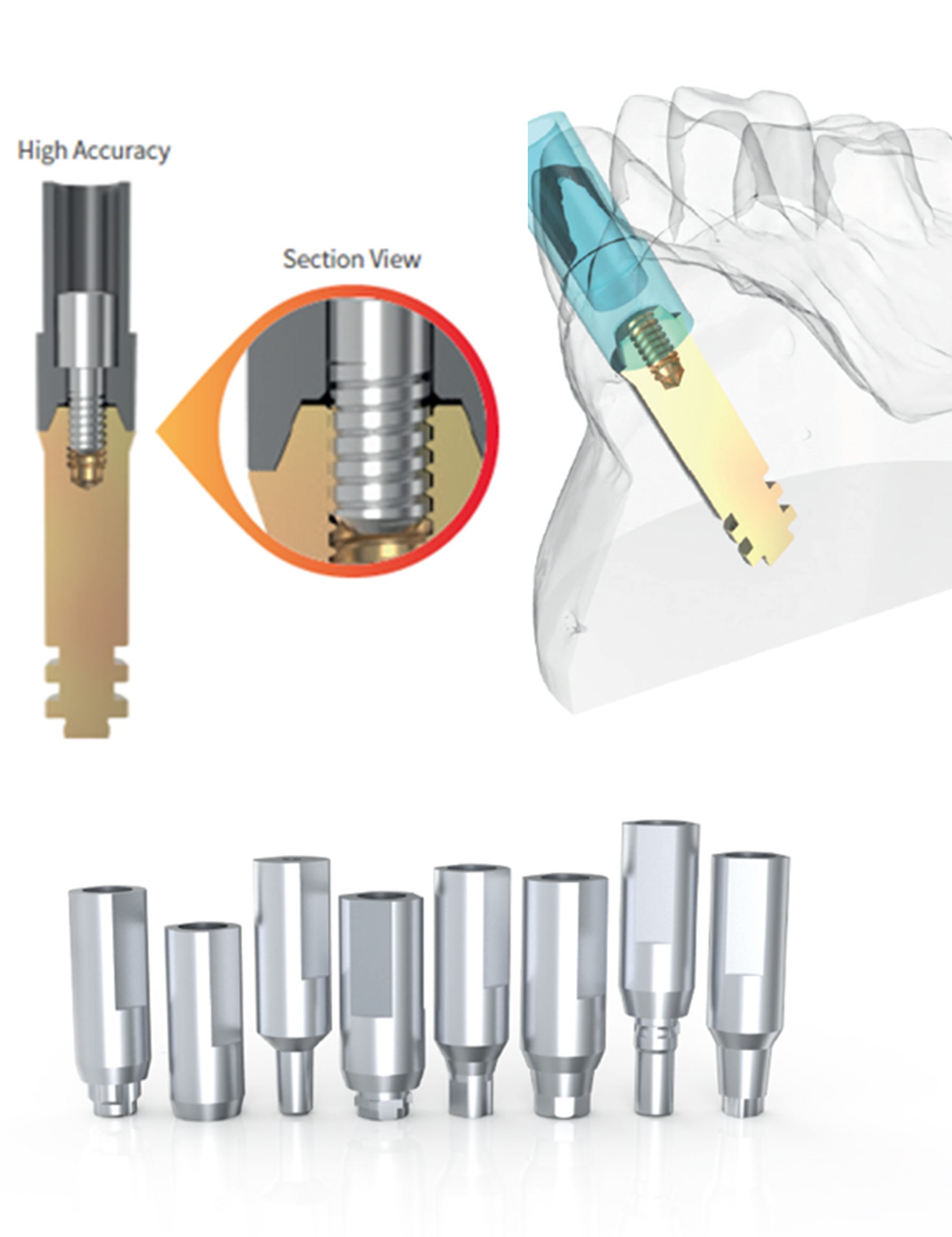 Scan Arum Abutments & Implant Components