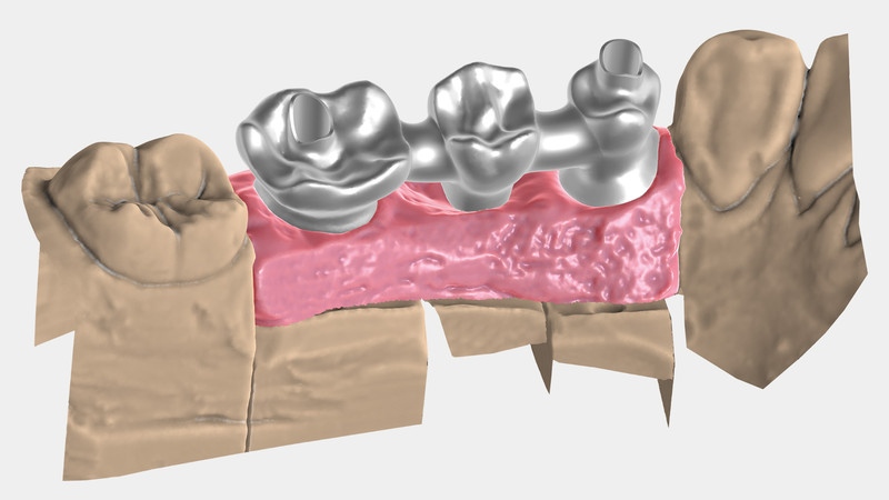 Dental CAD Software